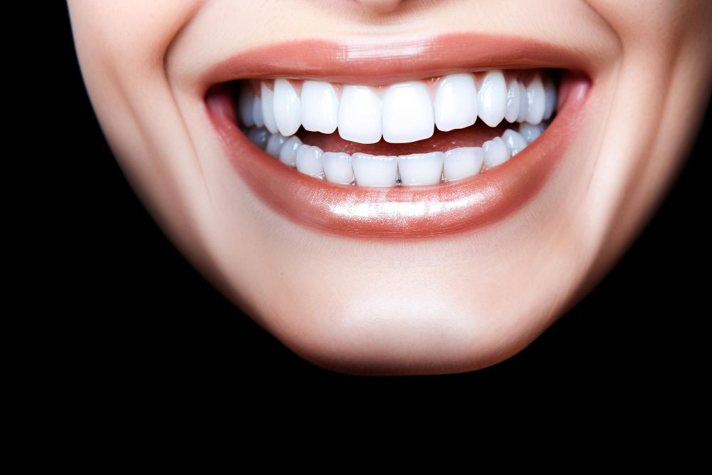 Teeth Whitening Cost in Dubai: An In-depth Analysis